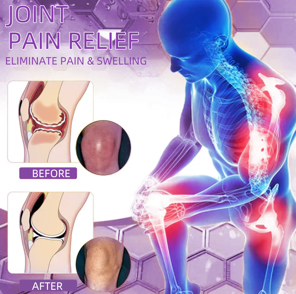 𝐎𝐟𝐟𝐢𝐜𝐢𝐚𝐥 𝐒𝐭𝐨𝐫𝐞: 𝐓𝐋𝐎𝐏𝐀® 𝑺𝒉𝒂𝒓𝒌 𝑪𝒂𝒓𝒕𝒊𝒍𝒂𝒈𝒆 𝑷𝒂𝒊𝒏-𝑺𝒐𝒐𝒕𝒉𝒊𝒏𝒈 𝑩𝒐𝒏𝒆 𝑹𝒆𝒄𝒐𝒗𝒆𝒓𝒚 𝑮𝒆𝒍 👨‍⚕️𝑨𝒎𝒆𝒓𝒊𝒄𝒂𝒏 𝑨𝒄𝒂𝒅𝒆𝒎𝒚 𝒐𝒇 𝑶𝒓𝒕𝒉𝒐𝒑𝒂𝒆𝒅𝒊𝒄 𝑺𝒖𝒓𝒈𝒆𝒐𝒏𝒔  𝒓𝒆𝒄𝒐𝒎𝒎𝒆𝒏𝒅 (5-𝗆𝗂𝗇𝗎𝗍𝖾 𝗉𝖺𝗂𝗇 𝗋𝖾𝗅𝗂𝖾𝖿, 𝟩 𝖽𝖺𝗒𝗌 𝗍𝗈 𝗋𝖾𝗌𝗍𝗈𝗋𝖾 𝗃𝗈𝗂𝗇𝗍 𝗆𝗈𝖻𝗂𝗅𝗂𝗍𝗒, 𝟦 𝗐𝖾𝖾𝗄𝗌 𝖿𝗈𝗋 𝖼𝗈𝗆𝗉𝗅𝖾𝗍𝖾 𝗁𝖾𝖺𝗅𝗂𝗇𝗀)🔥