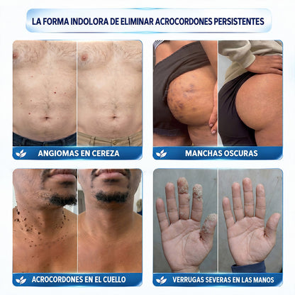 Dyceco® ☁️7 𝒅í𝒂𝒔 𝑪𝒓𝒆𝒎𝒂 𝒃𝒐𝒓𝒓𝒂𝒅𝒐𝒓𝒂 𝒅𝒆 𝒂𝒄𝒓𝒐𝒄𝒐𝒓𝒅𝒐𝒏𝒆𝒔 𝒚 𝒎𝒂𝒏𝒄𝒉𝒂𝒔 (𝑭ó𝒓𝒎𝒖𝒍𝒂 𝑰𝒏𝒄𝒐𝒍𝒐𝒓𝒂 𝒚 𝑺𝒊𝒏 𝑫𝒐𝒍𝒐𝒓)