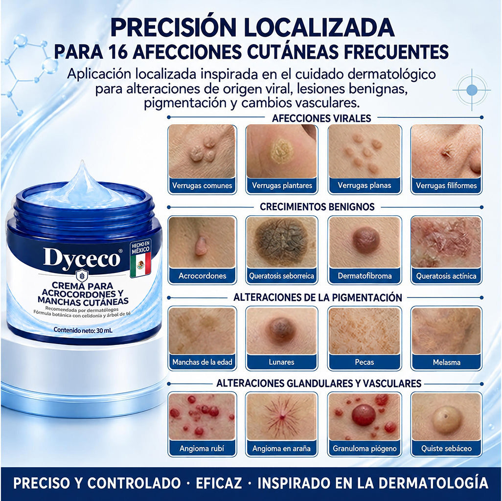 Dyceco® ☁️7 𝒅í𝒂𝒔 𝑪𝒓𝒆𝒎𝒂 𝒃𝒐𝒓𝒓𝒂𝒅𝒐𝒓𝒂 𝒅𝒆 𝒂𝒄𝒓𝒐𝒄𝒐𝒓𝒅𝒐𝒏𝒆𝒔 𝒚 𝒎𝒂𝒏𝒄𝒉𝒂𝒔 (𝑭ó𝒓𝒎𝒖𝒍𝒂 𝑰𝒏𝒄𝒐𝒍𝒐𝒓𝒂 𝒚 𝑺𝒊𝒏 𝑫𝒐𝒍𝒐𝒓)