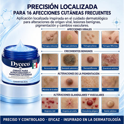 Dyceco® ☁️7 𝒅í𝒂𝒔 𝑪𝒓𝒆𝒎𝒂 𝒃𝒐𝒓𝒓𝒂𝒅𝒐𝒓𝒂 𝒅𝒆 𝒂𝒄𝒓𝒐𝒄𝒐𝒓𝒅𝒐𝒏𝒆𝒔 𝒚 𝒎𝒂𝒏𝒄𝒉𝒂𝒔 (𝑭ó𝒓𝒎𝒖𝒍𝒂 𝑰𝒏𝒄𝒐𝒍𝒐𝒓𝒂 𝒚 𝑺𝒊𝒏 𝑫𝒐𝒍𝒐𝒓)