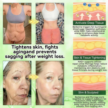 𝑶𝒇𝒇𝒊𝒄𝒊𝒂𝒍 𝒔𝒕𝒐𝒓𝒆 ☑️ | 🇺🇸Surgoᴎix® 𝐌𝐨𝐫𝐢𝐧𝒈𝗮 𝑩𝒆𝒓𝒃𝒆𝐫𝐢𝐧𝐞𝐱 𝐍𝗔𝒟+ 10-𝑖n-1 𝐍a𝒏𝒐 𝐌𝐢𝐜𝐫𝑜𝑛𝑒𝑒𝗱𝗹𝗲 𝐏𝐚𝒕𝒄𝒉🩵(𝐉𝐮𝐬𝐭 𝐨𝐧𝐜𝐞 𝐚 𝐝𝐚𝐲, 𝐯𝐢𝐬𝐢𝐛𝐥𝐞 𝐜𝐡𝐚𝐧𝐠𝐞𝐬 𝐢𝐧 𝟕 𝑫𝐚𝐲𝐬） 𝐅𝐨𝐫 𝐎𝐛𝐞𝐬𝐢𝐭𝐲,  𝙇𝙊𝙊𝙎𝗘 𝗦𝗞𝗜𝗡,𝐝𝐢𝐚𝐛𝐞𝐭𝙚𝙨, 𝐬𝐥𝐞𝐞𝐏 𝐚𝐩𝐧𝐞𝐚, 𝐣𝐨𝐢𝐧𝐭 𝐢𝐬𝐬𝐮𝙚𝙨, 𝐚𝐧𝐝 𝐦𝐨𝐫𝐞 🚀
