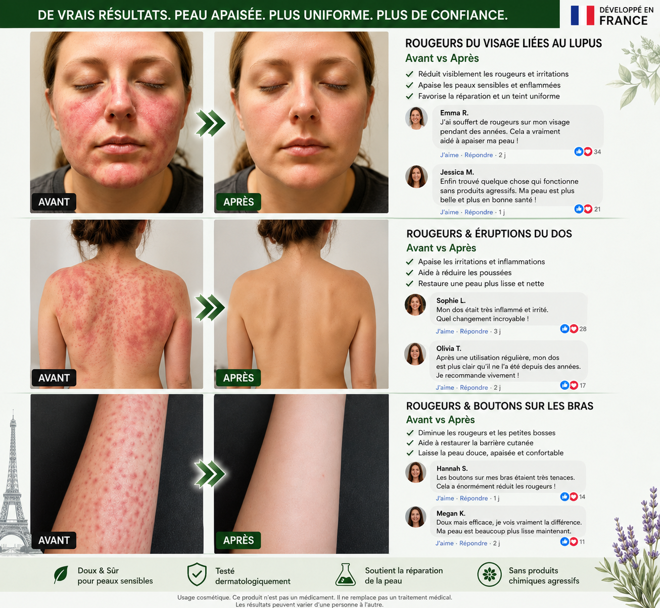 𝑩𝒐𝒖𝒕𝒊𝒒𝒖𝒆 𝒐𝒇𝒇𝒊𝒄𝒊𝒆𝒍𝒍𝒆 🇫🇷| 𝖲𝗎𝗋𝗀𝗈ᴎ𝗂𝗑® 📍𝐏𝐚𝙩𝙘𝙝 𝗡ano-Microneedles Avancé 10-en-1 Moringa · 𝘽𝙚𝙧𝙗é𝙧𝒊𝒏𝒆 × NAD⁺Une seule fois par jour, changements visibles en 7 jours Pour l’obésité, peau relâchée, diabète, apnée du sommeil, problèmes articulaires, et bien plus🍀